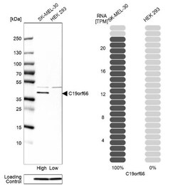 RyDEN Antibody, Novus Biologicals:Antibodies:Primary Antibodies